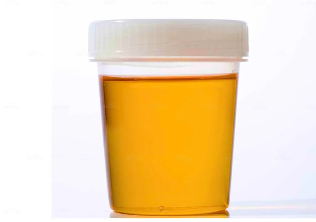 Picture for Nước tiểu màu cam: Nguyên nhân, dấu hiệu và cách điều trị | Dược Bình Đông