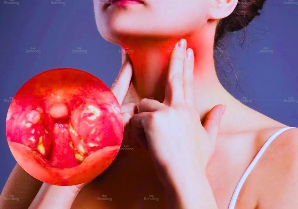 Picture for Ngứa Cổ Họng Ho Về Đêm - Nguyên Nhân Gây Khó Chịu Vào Ban Đêm